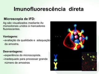 Imunofluorescência  direta Microscopia de IFD: Ag são visualizados mediante Ac monoclonais unidos à marcadores fluorescentes. Vantagens: avaliação da qualidade e  adequação  da amostra. Desvantagens:  experiência do microscopista. inadequado para processar grande  número de amostras Anticorpo monoclonal (LPS) Célula infectada Anticorpo monoclonal (MOMP) 