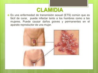 CLAMIDIA
 Es una enfermedad de transmisión sexual (ETS) común que es
fácil de curar, puede infectar tanto a los hombres como a las
mujeres. Puede causar daños graves y permanentes en el
aparato reproductor de una mujer.
 