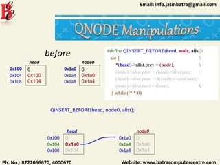 Website: www.batracomputercentre.comPh. No.: 8222066670, 4000670
Email: info.jatinbatra@gmail.com
#define QINSERT_BEFORE(head, node, alist)
do { 
*(head)->alist.prev = (node); 
(node)->alist.prev = (head)->alist.prev; 
(head)->alist.prev = &(node)->alist.next;
(node)->alist.next = (head); 
} while (/* */0)
0x100 0
0x100
0x104
head
0x104
0x108
0x1a0 0
0x1a0
0x1a4
node0
0x1a4
0x1a8
QINSERT_BEFORE(head, node0, alist);
0x100 0
0x1a0
0x104
head
0x104
0x108
0x1a0 0
0x1a0
0x1a4
node0
0x1a4
0x1a8
before
 
