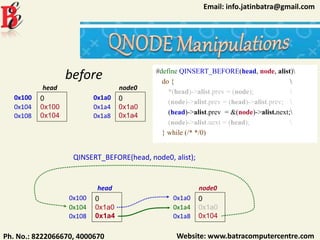 Website: www.batracomputercentre.comPh. No.: 8222066670, 4000670
Email: info.jatinbatra@gmail.com
#define QINSERT_BEFORE(head, node, alist)
do { 
*(head)->alist.prev = (node); 
(node)->alist.prev = (head)->alist.prev; 
(head)->alist.prev = &(node)->alist.next;
(node)->alist.next = (head); 
} while (/* */0)
0x100 0
0x100
0x104
head
0x104
0x108
0x1a0 0
0x1a0
0x1a4
node0
0x1a4
0x1a8
QINSERT_BEFORE(head, node0, alist);
0x100 0
0x1a0
0x1a4
head
0x104
0x108
0x1a0 0
0x1a0
0x104
node0
0x1a4
0x1a8
before
 