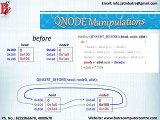 Website: www.batracomputercentre.comPh. No.: 8222066670, 4000670
Email: info.jatinbatra@gmail.com
#define QINSERT_BEFORE(head, node, alist)
do { 
*(head)->alist.prev = (node); 
(node)->alist.prev = (head)->alist.prev; 
(head)->alist.prev = &(node)->alist.next;
(node)->alist.next = (head); 
} while (/* */0)
0x100 0
0x100
0x104
head
0x104
0x108
0x1a0 0
0x1a0
0x1a4
node0
0x1a4
0x1a8
QINSERT_BEFORE(head, node0, alist);
0x100 0
0x1a0
0x1a4
head
0x104
0x108
0x1a0 0
0x100
0x104
node0
0x1a4
0x1a8
before
 