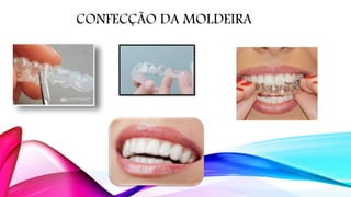 CONFECÇÃO DA MOLDEIRA
 