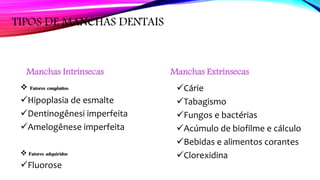 TIPOS DE MANCHAS DENTAIS
Manchas Intrínsecas
 Fatores congênitos
Hipoplasia de esmalte
Dentinogênesi imperfeita
Amelogênese imperfeita
 Fatores adquiridos
Fluorose
Manchas Extrínsecas
Cárie
Tabagismo
Fungos e bactérias
Acúmulo de biofilme e cálculo
Bebidas e alimentos corantes
Clorexidina
 