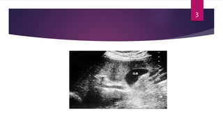 Clarus Normal CLARIUS ULTRASOUND.pptx