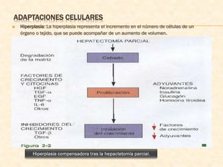 ADAPTACIONES CELULARES
   Hiperplasia: La hiperplasia representa el incremento en el número de células de un
    órgano o tejido, que se puede acompañar de un aumento de volumen.
 