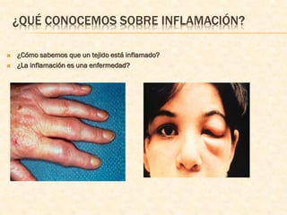 ¿QUÉ CONOCEMOS SOBRE INFLAMACIÓN?

   ¿Cómo sabemos que un tejido está inflamado?
   ¿La inflamación es una enfermedad?
 