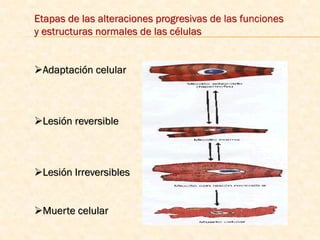 Etapas de las alteraciones progresivas de las funciones
y estructuras normales de las células


Adaptación celular



Lesión reversible



Lesión Irreversibles


Muerte celular
 