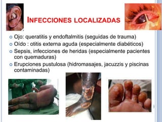 INFECCIONES LOCALIZADAS
 Ojo: queratitis y endoftalmitis (seguidas de trauma)
 Oído : otitis externa aguda (especialmente diabéticos)
 Sepsis, infecciones de heridas (especialmente pacientes
  con quemaduras)
 Erupciones pustulosa (hidromasajes, jacuzzis y piscinas
  contaminadas)
 