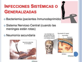 INFECCIONES SISTÉMICAS O
GENERALIZADAS
 Bacteriemia   (pacientes Inmunodeprimidos)

 Sistema
        Nervioso Central (cuando las
 meninges están rotas)

 Neumonía   secundaria
 
