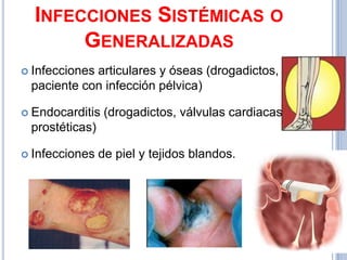 INFECCIONES SISTÉMICAS O
       GENERALIZADAS
 Infecciones
            articulares y óseas (drogadictos, o
 paciente con infección pélvica)

 Endocarditis   (drogadictos, válvulas cardiacas
 prostéticas)

 Infecciones   de piel y tejidos blandos.
 