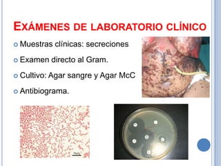 EXÁMENES DE LABORATORIO CLÍNICO
 Muestras    clínicas: secreciones
 Examen     directo al Gram.
 Cultivo:   Agar sangre y Agar McC
 Antibiograma.
 