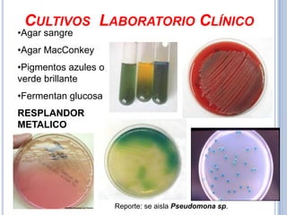 CULTIVOS LABORATORIO CLÍNICO
•Agar sangre
•Agar MacConkey
•Pigmentos azules o
verde brillante
•Fermentan glucosa
RESPLANDOR
METALICO




                      Reporte: se aisla Pseudomona sp.
 