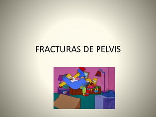 FRACTURAS DE PELVIS
 