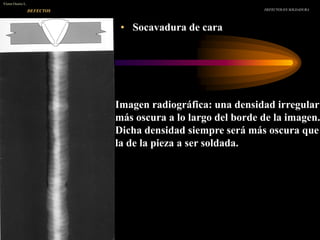 • Socavadura de cara
DEFECTOS EN SOLDADURA
Víctor Osorio L.
DEFECTOS
Imagen radiográfica: una densidad irregular
más oscura a lo largo del borde de la imagen.
Dicha densidad siempre será más oscura que
la de la pieza a ser soldada.
 