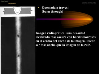 • Quemada a traves:
(burn through)
DEFECTOS EN SOLDADURA
Víctor Osorio L.
DEFECTOS
Imagen radiográfica: una densidad
localizada mas oscura con bordes borrosos
en el centro del ancho de la imagen. Puede
ser mas ancha que la imagen de la raíz.
 