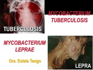 MYCOBACTERIUM
                      TUBERCULOSIS


MYCOBACTERIUM
   LEPRAE
 Dra. Estela Tango
                             LEPRA
 