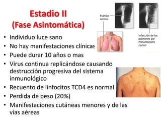 Estadio II
    (Fase Asintomática)
• Individuo luce sano
• No hay manifestaciones clínicas
• Puede durar 10 años o mas
• Virus continua replicándose causando
  destrucción progresiva del sistema
  inmunológico
• Recuento de linfocitos TCD4 es normal
• Perdida de peso (20%)
• Manifestaciones cutáneas menores y de las
  vías aéreas
 