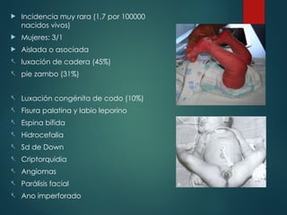  Incidencia muy rara (1,7 por 100000
nacidos vivos)
 Mujeres: 3/1
 Aislada o asociada
- luxación de cadera (45%)
- pie zambo (31%)
- Luxación congénita de codo (10%)
- Fisura palatina y labio leporino
- Espina bífida
- Hidrocefalia
- Sd de Down
- Criptorquidia
- Angiomas
- Parálisis facial
- Ano imperforado
 