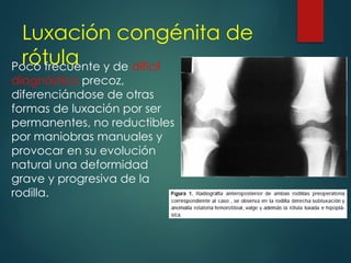 Luxación congénita de
rótula
Poco frecuente y de difícil
diagnóstico precoz,
diferenciándose de otras
formas de luxación por ser
permanentes, no reductibles
por maniobras manuales y
provocar en su evolución
natural una deformidad
grave y progresiva de la
rodilla.
 