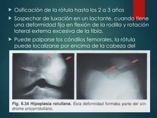  Osificación de la rótula hasta los 2 a 3 años
 Sospechar de luxación en un lactante, cuando tiene
una deformidad fija en flexión de la rodilla y rotación
lateral externa excesiva de la tibia.
 Puede palparse los cóndilos femorales, la rótula
puede localizarse por encima de la cabeza del
peroné
 