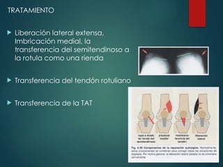 TRATAMIENTO
 Liberación lateral extensa,
Imbricación medial, la
transferencia del semitendinoso a
la rotula como una rienda
 Transferencia del tendón rotuliano
 Transferencia de la TAT
 