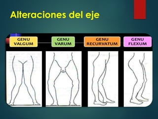Alteraciones del eje
 