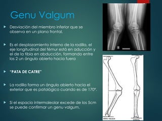 Genu Valgum
 Desviación del miembro inferior que se
observa en un plano frontal.
 Es el desplazamiento interno de la rodilla, el
eje longitudinal del fémur está en aducción y
el de la tibia en abducción, formando entre
los 2 un ángulo abierto hacia fuera
 “PATA DE CATRE”
 La rodilla forma un ángulo abierto hacia el
exterior que es patológico cuando es de 170º.
 Si el espacio intermaleolar excede de los 5cm
se puede confirmar un genu valgum.
 