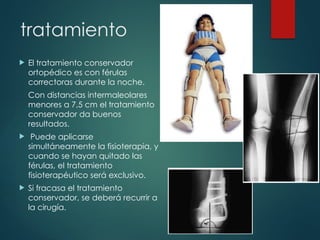 tratamiento
 El tratamiento conservador
ortopédico es con férulas
correctoras durante la noche.
Con distancias intermaleolares
menores a 7,5 cm el tratamiento
conservador da buenos
resultados.
 Puede aplicarse
simultáneamente la fisioterapia, y
cuando se hayan quitado las
férulas, el tratamiento
fisioterapéutico será exclusivo.
 Si fracasa el tratamiento
conservador, se deberá recurrir a
la cirugía.
 