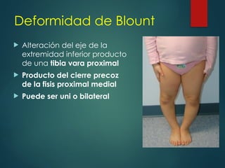 Deformidad de Blount
 Alteración del eje de la
extremidad inferior producto
de una tibia vara proximal
 Producto del cierre precoz
de la fisis proximal medial
 Puede ser uni o bilateral
 