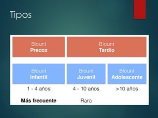 Tipos
 