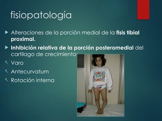 fisiopatología
 Alteraciones de la porción medial de la fisis tibial
proximal.
 Inhibición relativa de la porción posteromedial del
cartilago de crecimiento:
- Varo
- Antecurvatum
- Rotación interna
 