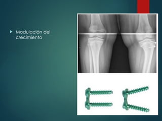  Modulación del
crecimiento
 