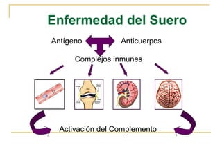 Enfermedad del Suero
Antígeno          Anticuerpos

      Complejos inmunes




  Activación del Complemento
 