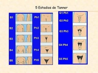 5 Estadios de Tanner
 