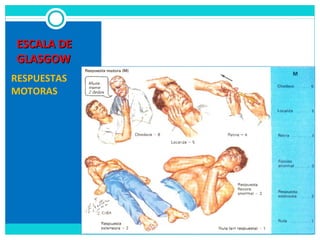 ESCALA DEESCALA DE
GLASGOWGLASGOW
RESPUESTAS
MOTORAS
 