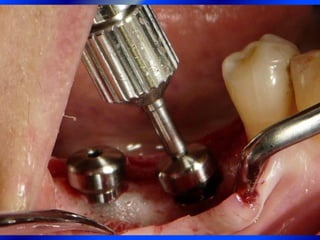 Clase Conexiones 2008 Alumn