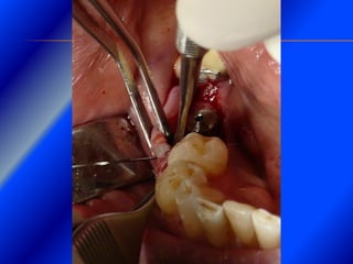 Clase Conexiones 2008 Alumn