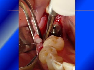 Clase Conexiones 2008 Alumn