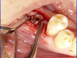 Clase Conexiones 2008 Alumn