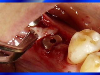 Clase Conexiones 2008 Alumn