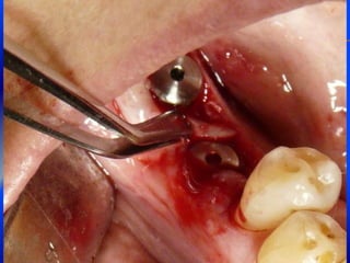 Clase Conexiones 2008 Alumn