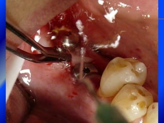 Clase Conexiones 2008 Alumn