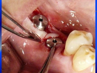 Clase Conexiones 2008 Alumn