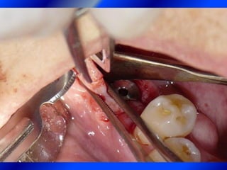 Clase Conexiones 2008 Alumn