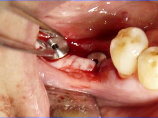 Clase Conexiones 2008 Alumn