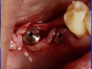 Clase Conexiones 2008 Alumn