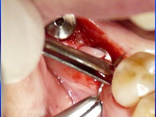 Clase Conexiones 2008 Alumn