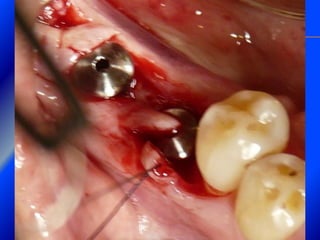 Clase Conexiones 2008 Alumn