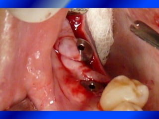 Clase Conexiones 2008 Alumn