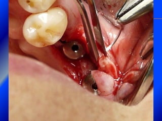 Clase Conexiones 2008 Alumn